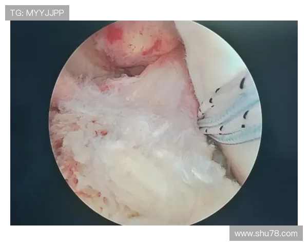 奥德里奥索拉成功完成十字韧带手术